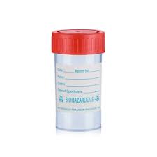 Sputum Container 20ml, 30ml, 40ml
